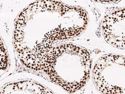 Immunohistochemistry-Paraffin: ETV5/ERM Antibody [NBP2-98876]