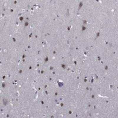 Immunohistochemistry-Paraffin: ETV5/ERM Antibody [NBP3-17656]