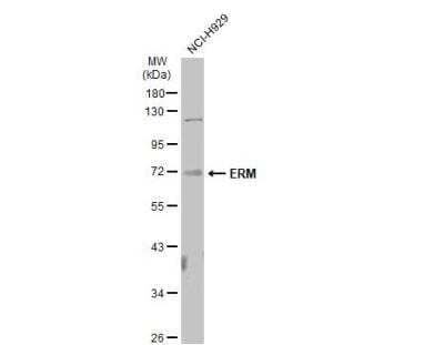 Western Blot: ETV5/ERM Antibody [NBP2-14950]