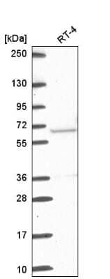 Western Blot: ETV5/ERM Antibody [NBP2-55689]