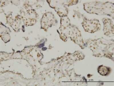 Immunohistochemistry-Paraffin: ETV6/Tel Antibody (3B10) [H00002120-M01]