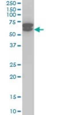 Western Blot: ETV6/Tel Antibody (3B10) [H00002120-M01]