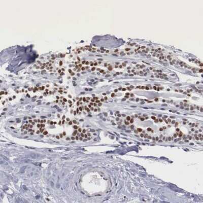 Immunohistochemistry-Paraffin: ETV6/Tel Antibody [NBP1-80695]