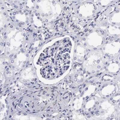 Immunohistochemistry-Paraffin: ETV6/Tel Antibody [NBP1-80695]