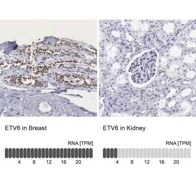 Immunohistochemistry-Paraffin: ETV6/Tel Antibody [NBP1-80695]