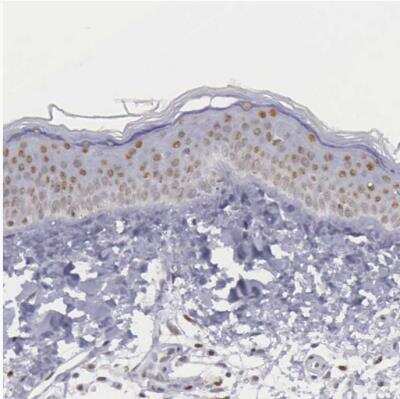 Immunohistochemistry-Paraffin: ETV6/Tel Antibody [NBP1-80695]