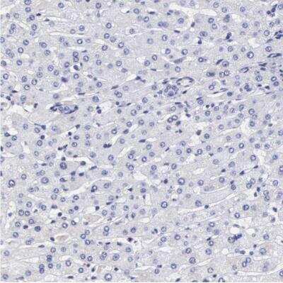 Immunohistochemistry-Paraffin: ETV6/Tel Antibody [NBP1-80695]