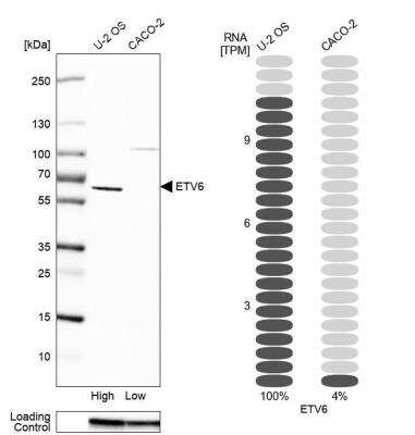 Western Blot: ETV6/Tel Antibody [NBP1-80695]