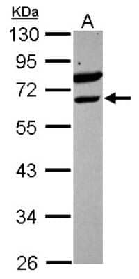 Western Blot: ETV6/Tel Antibody [NBP2-16387]