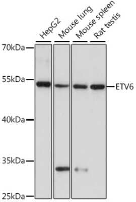 Western Blot: ETV6/Tel AntibodyAzide and BSA Free [NBP3-03434]