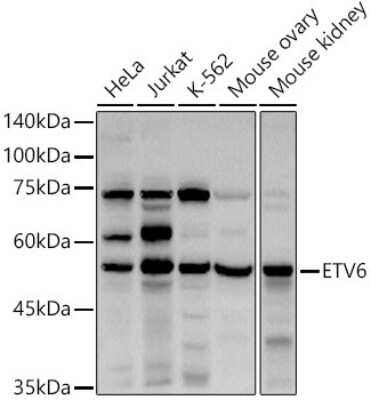 Western Blot: ETV6/Tel AntibodyAzide and BSA Free [NBP3-03435]