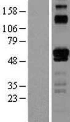 Western Blot: ETV6/Tel Overexpression Lysate [NBL1-10362]