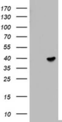 Western Blot: ETV7 Antibody (OTI3B2) [NBP2-45544]