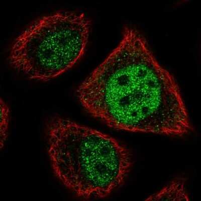 Immunocytochemistry/ Immunofluorescence: ETV7 Antibody [NBP2-68687]