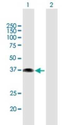 Western Blot: ETV7 Antibody [H00051513-B01P]