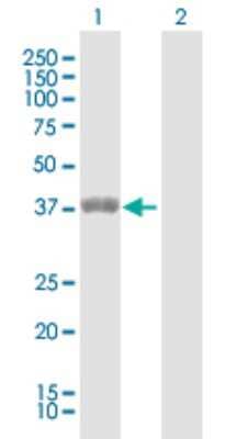 Western Blot: ETV7 Antibody [H00051513-D01P]