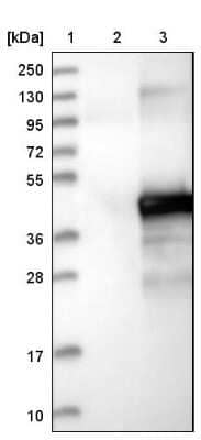 Western Blot: ETV7 Antibody [NBP1-80694]