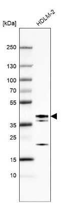 Western Blot: ETV7 Antibody [NBP1-80694]