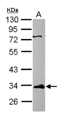 Western Blot: ETV7 Antibody [NBP2-16388]