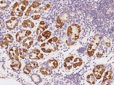 Immunohistochemistry-Paraffin: EVA1/MPZL2 Antibody [NBP2-98520]