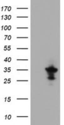 Western Blot: EVA1/MPZL2 Antibody (OTI2C7)Azide and BSA Free [NBP2-71553]