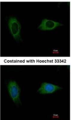 Immunocytochemistry/ Immunofluorescence: EVC2 Antibody [NBP1-31268]