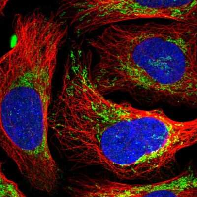 Immunocytochemistry/ Immunofluorescence: EVC2 Antibody [NBP2-47467]