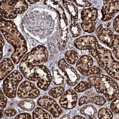 Immunohistochemistry: EVC2 Antibody [NBP2-47467]