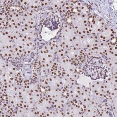 Immunohistochemistry: EVC2 Antibody [NBP2-48889]