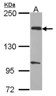 Western Blot: EVC2 Antibody [NBP1-31268]