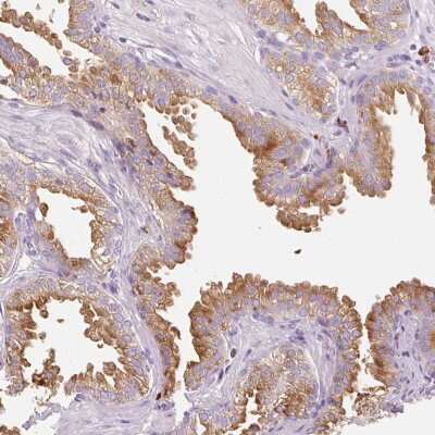 Immunohistochemistry: EVER2 Antibody [NBP2-49129]