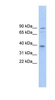 Western Blot: EVER2 Antibody [NBP1-57812]