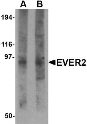 Western Blot: EVER2 AntibodyBSA Free [NBP1-76368]