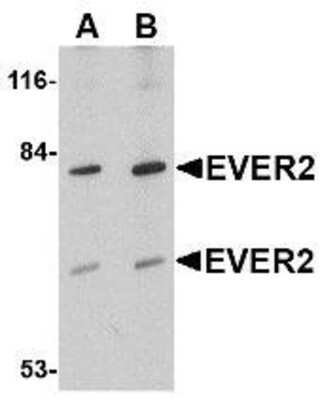 Western Blot: EVER2 AntibodyBSA Free [NBP1-76903]