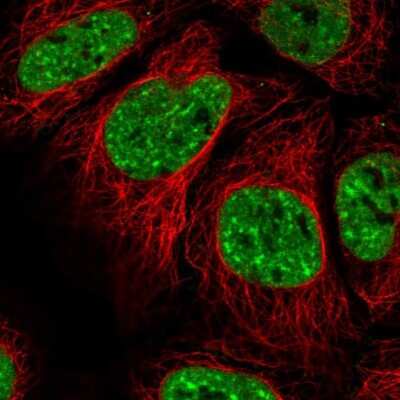 Immunocytochemistry/ Immunofluorescence: EVI-1 Antibody [NBP2-48848]