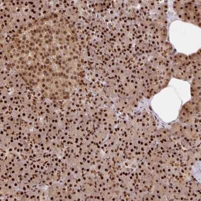 Immunohistochemistry-Paraffin: EVI-1 Antibody [NBP2-48848]
