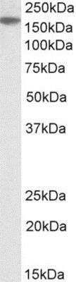 Western Blot: EVI-1 Antibody [NBP1-52024]