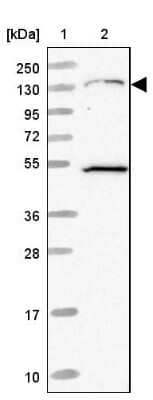 Western Blot: EVI-1 Antibody [NBP2-48848]