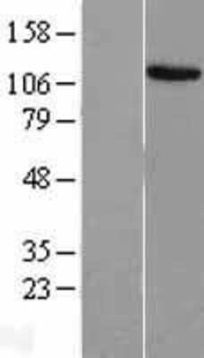 Western Blot: EVI-1 Overexpression Lysate [NBL1-10364]