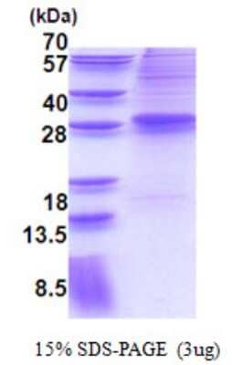 SDS-PAGE: Recombinant Human EVI-1 His Protein [NBP2-22647]