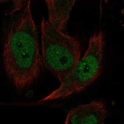 Immunocytochemistry/ Immunofluorescence: EVI2A Antibody [NBP2-55341]