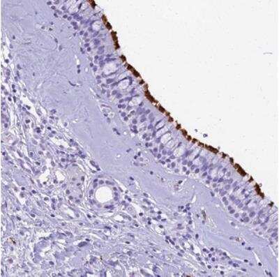 Immunohistochemistry: EVI2A Antibody [NBP2-30525]