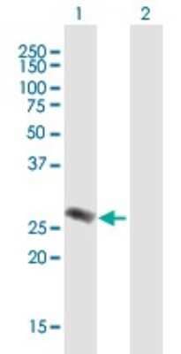 Western Blot: EVI2A Antibody [H00002123-B01P]