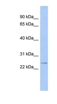 Western Blot: EVI2A Antibody [NBP1-68926]