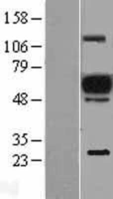 Western Blot: EVI2A Overexpression Lysate [NBL1-10365]