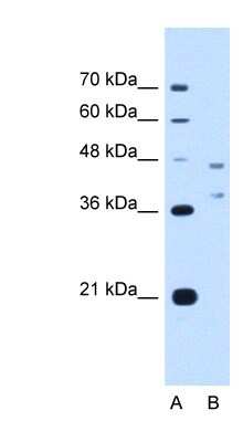 Western Blot: EVI2B Antibody [NBP1-59952]