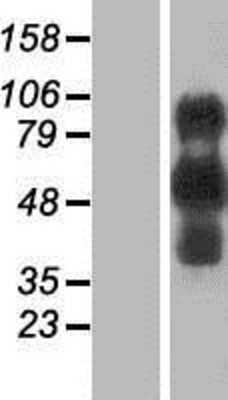 Western Blot: EVI2B Overexpression Lysate [NBP2-07613]