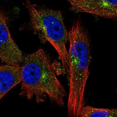 Immunocytochemistry/ Immunofluorescence: EVI5 Antibody [NBP2-58616]