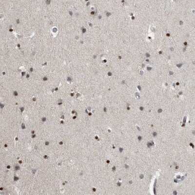 Immunohistochemistry-Paraffin: EVI5 Antibody [NBP1-82596]