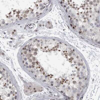 Immunohistochemistry-Paraffin: EVI5 Antibody [NBP1-82596]